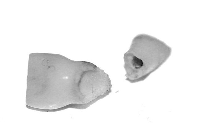 What Did The Ending T0 Milk Teeth Mean