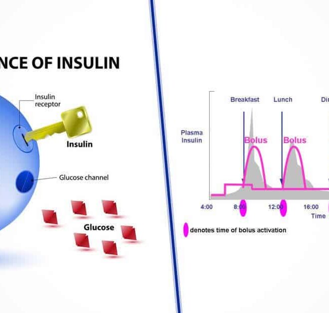 What Does Insulin On Board Mean