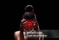 What Does Pain Radiate Mean