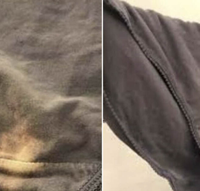 What Does A Bleach Stain In Your Underwear Mean