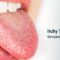 What Does It Mean When Your Tongue Is Itchy