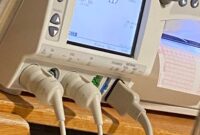 What Does The Toco Number Mean