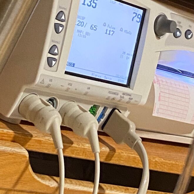 What Does The Toco Number Mean