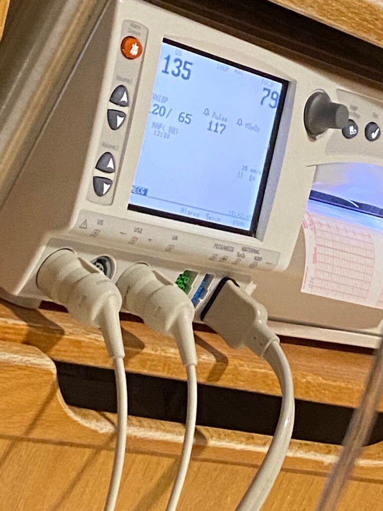 What Does The Toco Number Mean