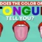 What Does Black Dots On Your Tongue Mean