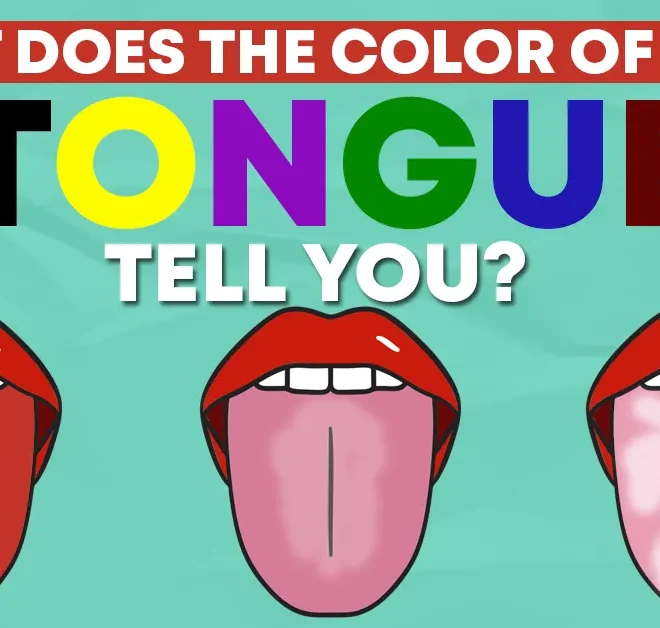 What Does Black Dots On Your Tongue Mean