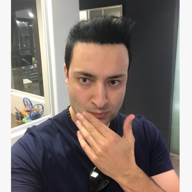 What Does It Mean When You Bite Your Cheek