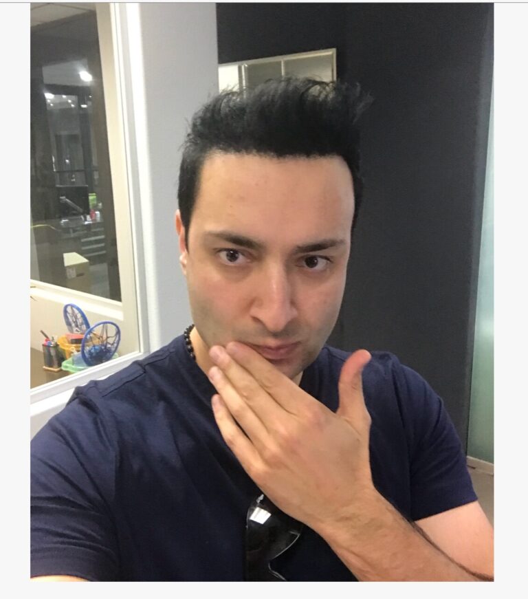 What Does It Mean When You Bite Your Cheek