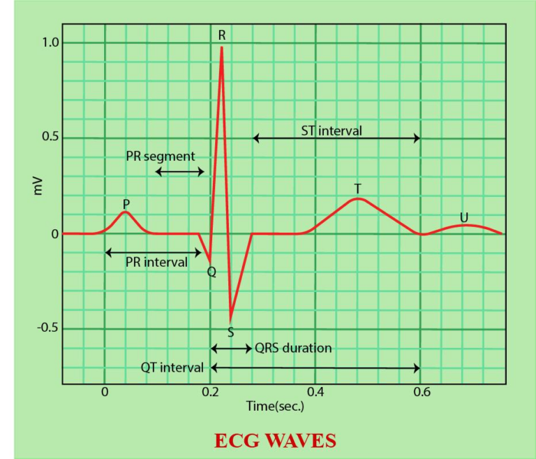 What Is The Meaning Of Borderline Ecg