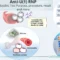 What Does Rnp Antibodies 0.2 Mean