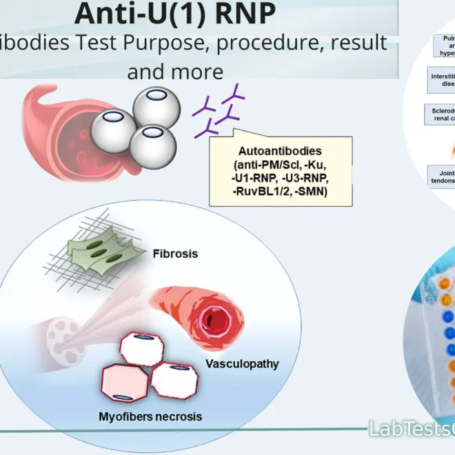 What Does Rnp Antibodies 0.2 Mean