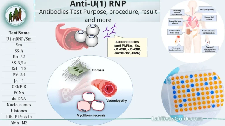 What Does Rnp Antibodies 0.2 Mean