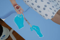 What Does It Mean When An Iv Is Infiltrated