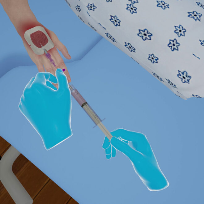 What Does It Mean When An Iv Is Infiltrated