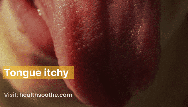 What Does It Mean When Your Tongue Is Itching