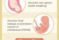 What Does A Watery Period Mean
