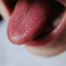 What Does Black Dots On Tongue Mean