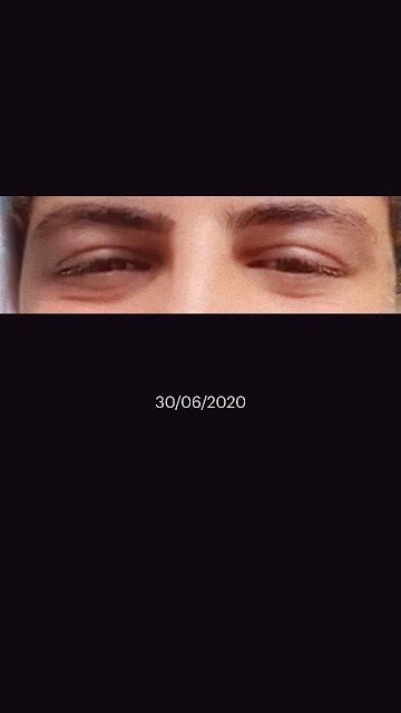 What Do The Little Eyes On Snapchat Mean