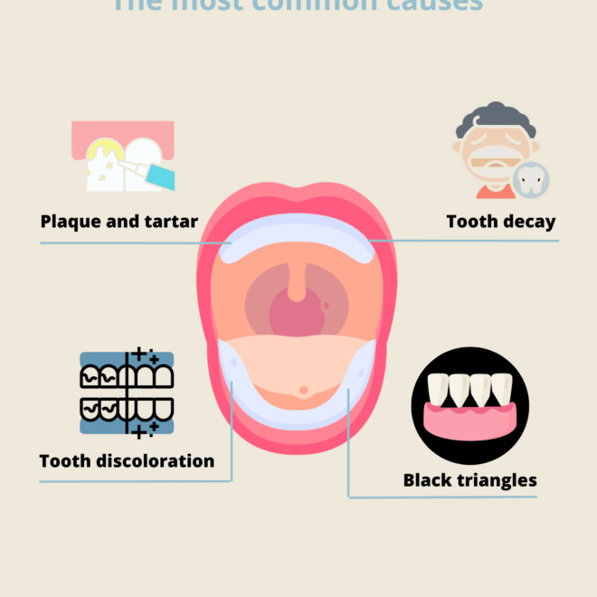What Does It Mean When Your Tooth Turns Black