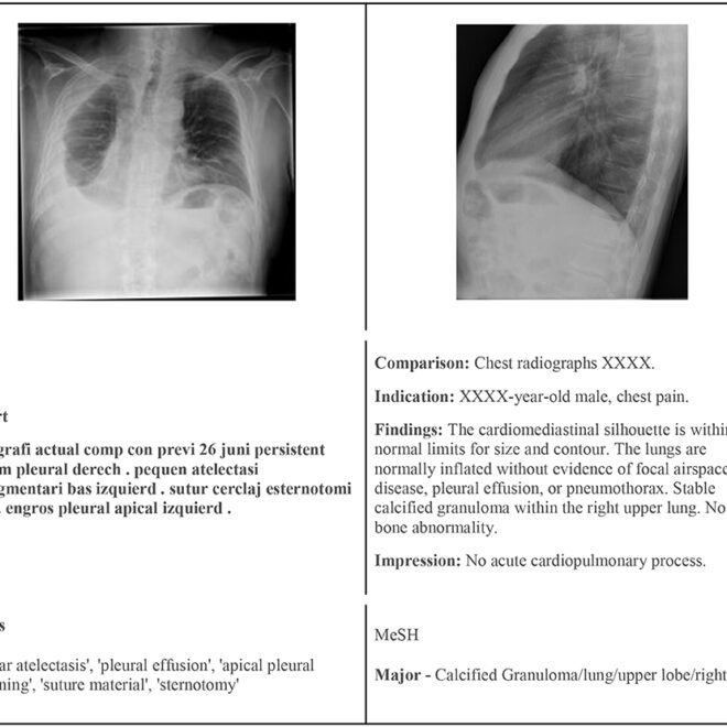 What Does No Acute Osseous Abnormality Mean