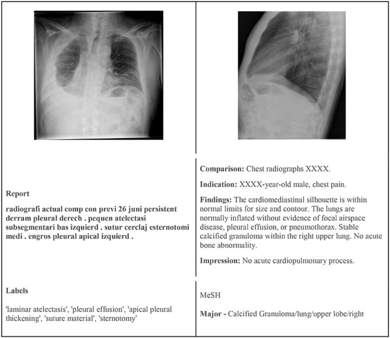 What Does No Acute Osseous Abnormality Mean