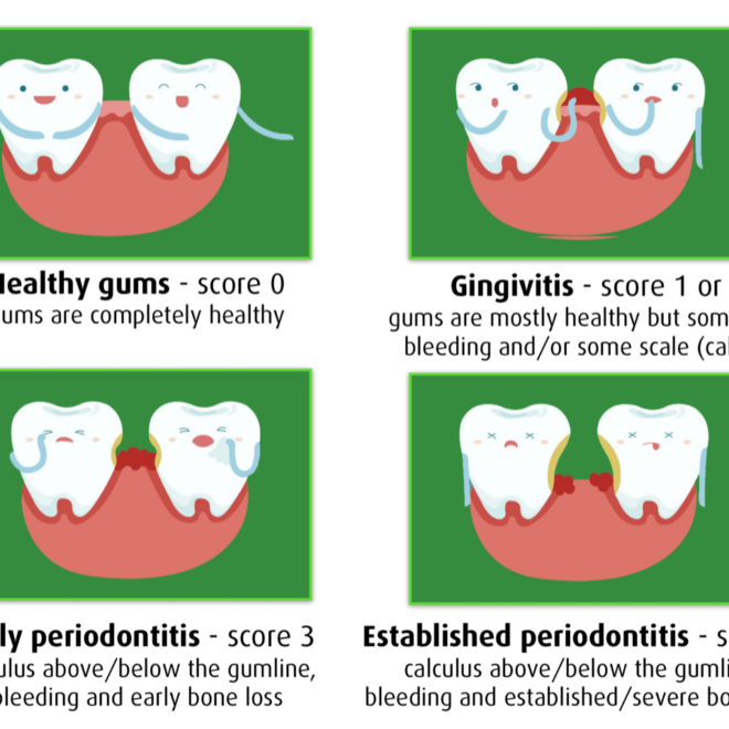 What Does A Gum Score Of 4 Mean