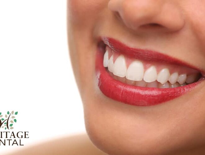 What Does Black Spots On Tongue Mean