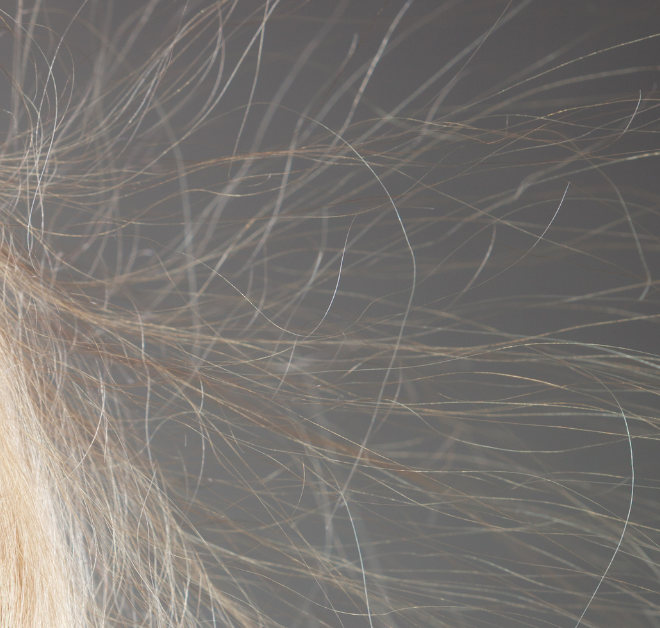 What Does It Mean When Your Hair Is Static