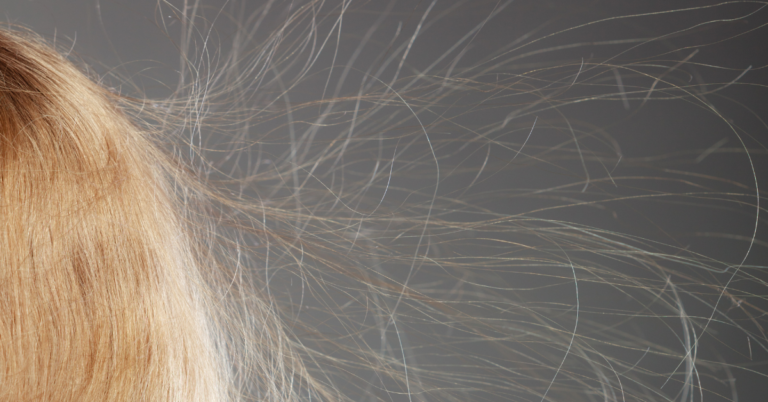 What Does It Mean When Your Hair Is Static