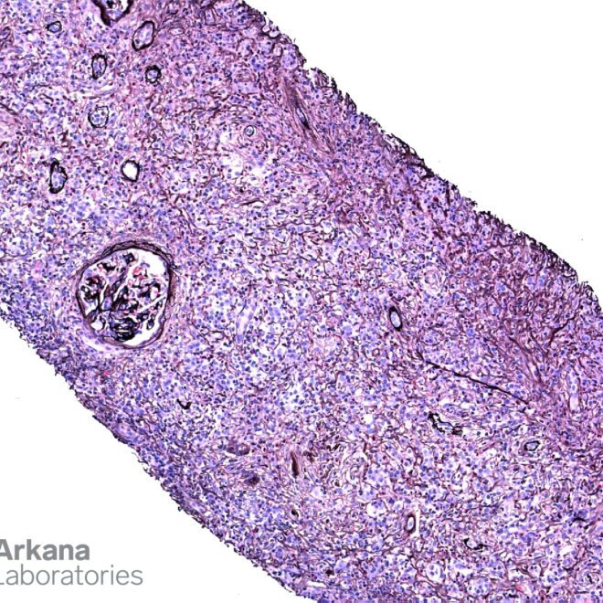 What Does Igg P41 Ab Present Abnormal Mean