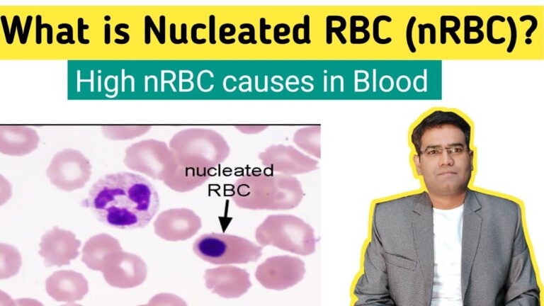 What Does High Nucleated Cells In Csf Mean