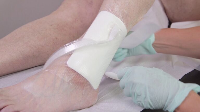 What Does It Mean When My Pico Dressing Keeps Buzzing