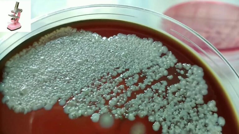 What Does Mixed Flora Mean In Urine