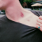 What Does A Hickey Mean To A Guy