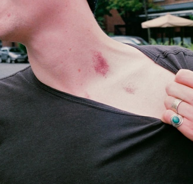 What Does A Hickey Mean To A Guy