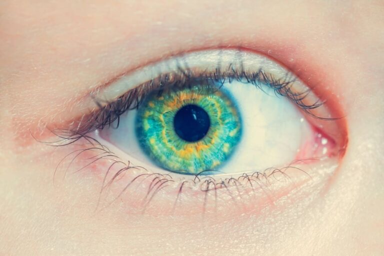What Does It Mean When You See Yellow Spots