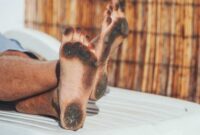 What Does It Mean When Your Feet Turn Black