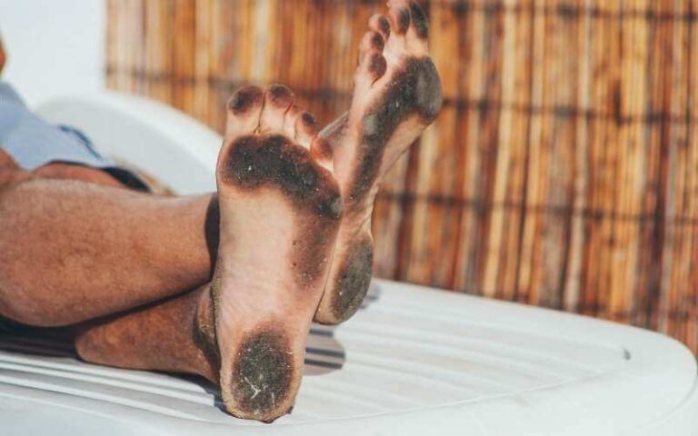 What Does It Mean When Your Feet Turn Black