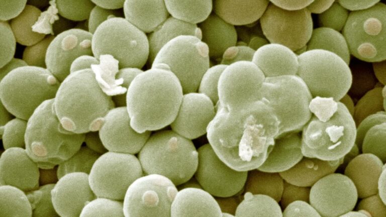 What Does It Mean If Saccharomyces Cerevisiae Igg Is High