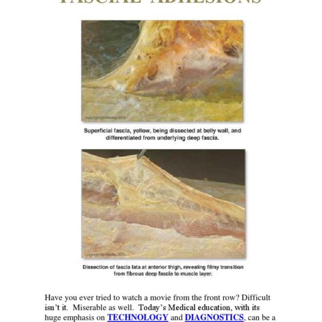 What Do Fascia Adhesions Feel Like? Symptoms Causes and Relief Options