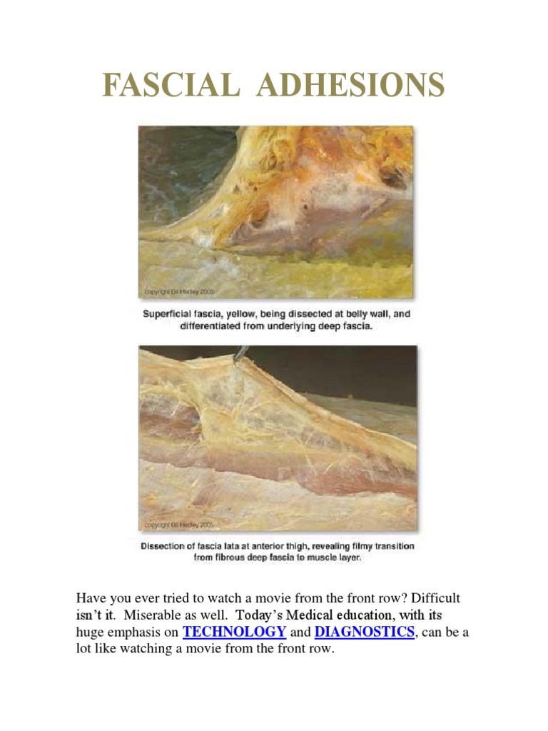 What Do Fascia Adhesions Feel Like? Symptoms Causes and Relief Options