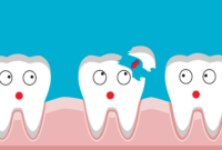 What Do You Do If You Chip Your Tooth? Immediate Steps and Dental Care