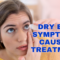 What Do Dry Eyes Look Like? Symptoms Causes and Relief Options