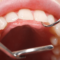 What Do Healthy Teeth Look Like? Signs of a Strong Smile
