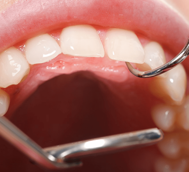 What Do Healthy Teeth Look Like? Signs of a Strong Smile