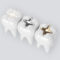 What Do Cavity Fillings Look Like? Types Colors and Materials