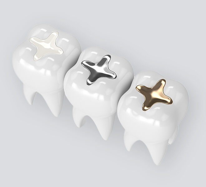 What Do Cavity Fillings Look Like? Types Colors and Materials