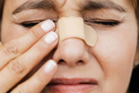 What Do Broken Noses Look Like? Signs Swelling and When to See a Doctor