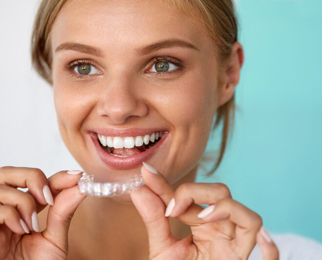 What Do Retainers Do? How They Keep Your Smile Perfect