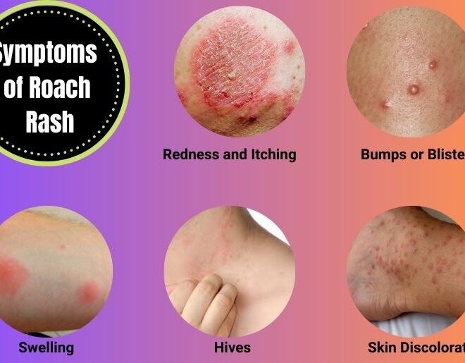 What Does a Roach Bite Look Like? Symptoms Photos and Treatment Tips